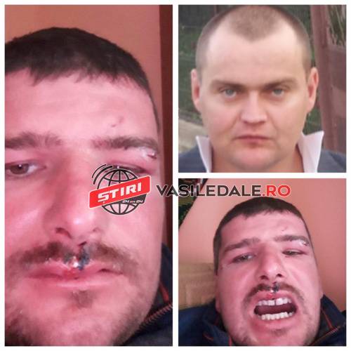 EXCLUSIV: Doi frați din Borșa bătuți la un interval de patru zile. Colț Alb susține că el ar fi fost atacat cu securea (FOTO/ACTUALIZARE)