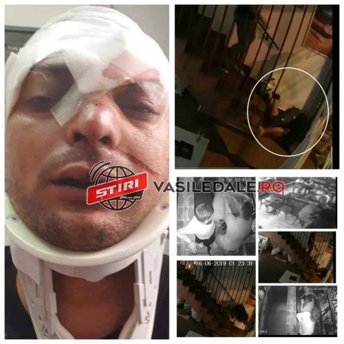 EXCLUSIV CITITORI – IMAGINI ÎNGROZITOARE / ACTUALIZARE: Un tânăr a fost bătut și aruncat în cap de pe scările unui club din Baia Mare (VIDEO – interviu cu victima)