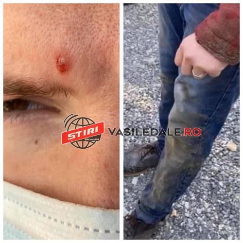 ȘTIRE CITITORI – FOTO EXCLUSIV / ACTUALIZARE: În Borșa, o artistă de muzică populară și soțul ei atacați cu pietre, agresați fizic și verbal