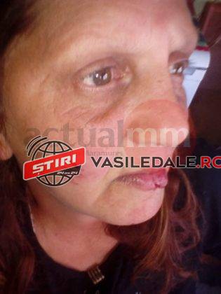 GRAV INCIDENT LA BUZEŞTI: O femeie de 51 de ani, victima unei tentative de viol (FOTO)