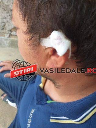 PRELUARE ACTUALMM.RO: Detalii despre altercaţia din Ferneziu. Unul dintre atacatori ar fi paznic la școala din cartier (FOTO)