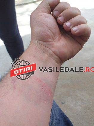 EXCLUSIV VIȘEU DE SUS: Bătaie cu repetiție între doi tineri după un conflict spontan