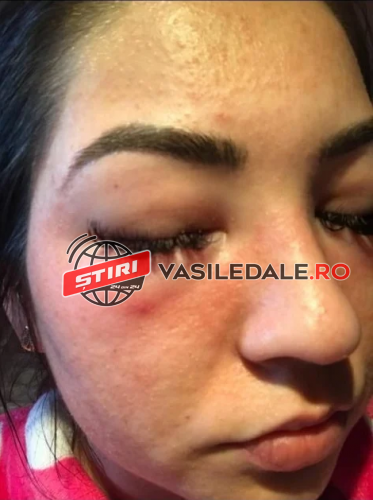 ȘOCANT: O sigheteancă a ajuns victima “dermatologului vedetelor”. A ajuns la spital în șoc anafilactic