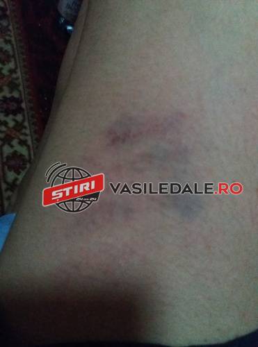 FOTO EXCLUSIV – VIOLENŢA ÎN FAMILIE ÎN MARAMUREŞ: O femeie din Satulung și cei patru copii bătuți de concubin