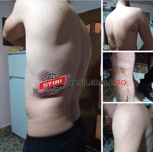 ȘOCANT: FOTO /VIDEO EXCLUSIV – Un bărbat din Vișeu de Sus susține că a fost bătut măr de trei polițiști tocmai în sediul POLIȚIEI (ACTUALIZARE)