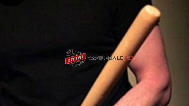 EXCLUSIV / CA ÎN FILMELE CU MAFIOŢI: Directorul unei firme din Vişeu de Sus lovit în cap în trafic. Suspectul ar fi “finuţul” unui fost inspector şef al Poliţiei Maramureş (ACTUALIZARE)