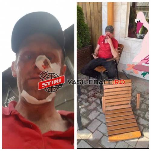 EXCLUSIV FOTO: Bărbat din Repedea bătut măr de doi localnici care ar fi simpatizanți USR