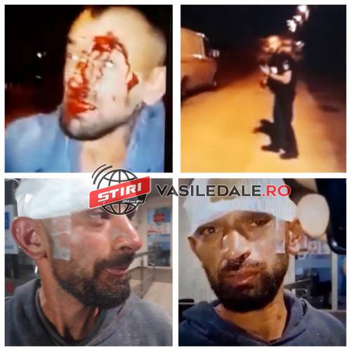 VIDEO EXCLUSIV: Un băimărean susține că ar fi fost desfigurat de polițiști sub privirile propriului copil de 6 ani. Petrecea de ziua soției lui. Poliția susține că a cazut pentru că era beat (actualizare)