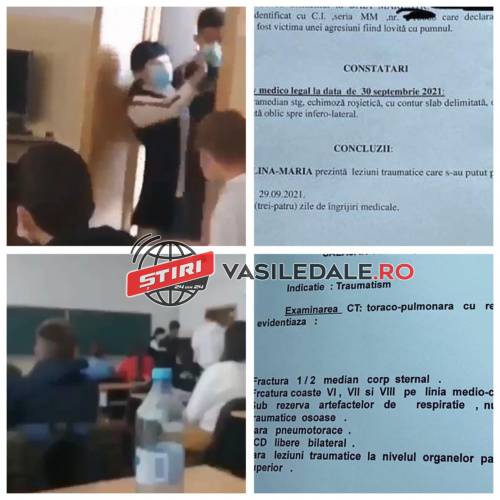 EXCLUSIV: Profesoara de biologie de la Colegiul Barițiu din Baia Mare are fractură de stern și trei coaste! Poliția a deschis dosar penal