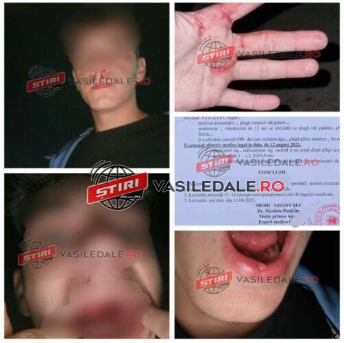 EXCLUSIV: COPIL de 13 ani BĂTUT de un localnic din Dragomirești. Vacanță de coșmar pentru adolescentul venit din Anglia la bunici (actualizare)