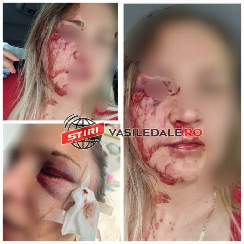 EXCLUSIV FOTO: Mărturii cutremurătoare – O băimăreancă a reușit să scape din ghearele morții și a ieșit plină de sânge în stradă sărind in faţa unei mașini să o ajute