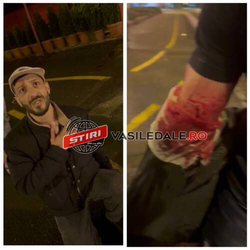 EXCLUSIV VIDEO: Mihăiță Sînă patronul de la ”Bucătarul Meu” atacat și tăiat în plină stradă în Baia Mare – actualizare