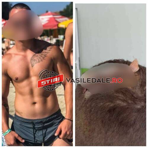 EXCLUSIV: Maramureșul SĂLBATIC, tentativă la omor – Doi tineri bătuți crunt cu răngile în stradă la Sighet. Un suspect ar fi fugit în Anglia