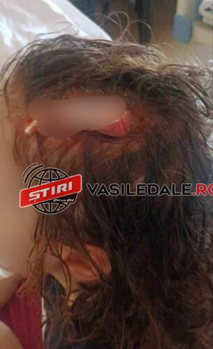 EXCLUSIV FOTO: Fetiţă de 4 ani, lovită de un adolescent care cobora de pe deal în Parcul Regina Maria din Baia Mare