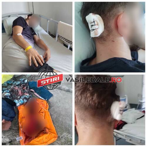 EXCLUSIV: Tânăr lovit cu halba de bere în cap într-un bar din Botiza. Agresorul – un adolescent de 18 ani