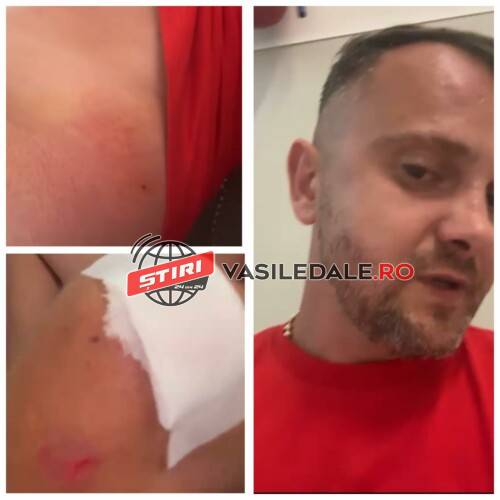 EXCLUSIV: Maramureșean bătut la o piscină ”INFINITY” din Maramureș. ”Am cheltuit vreo 3000 de euro și administratorii nici nu m-au întrebat dacă sunt bine”!