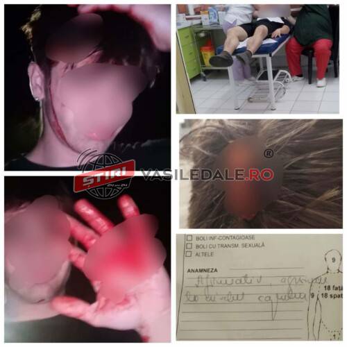 EXCLUSIVITATE: Un adolescent de 16 ani susține că ar fi fost lovit în cap de un patron din Ocna Șugatag. De cealaltă parte, cel acuzat susține că l-a prins la furat și doar s-a apărat