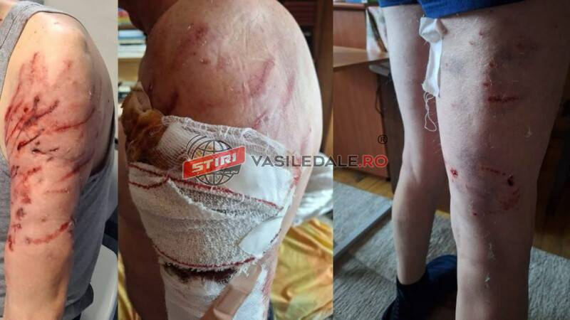 ȘOCANT: Un bărbat din Borcut (Tg Lăpuș) a fost atacat și sfâșiat de doi câini din rasa Kangal în propria grădină