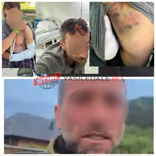 EXCLUSIV – ”Cantzone” din Rozavlea bătut crunt de cagulați după un LIVE. Procurorii tac mâlc pentru că nu au suspecți