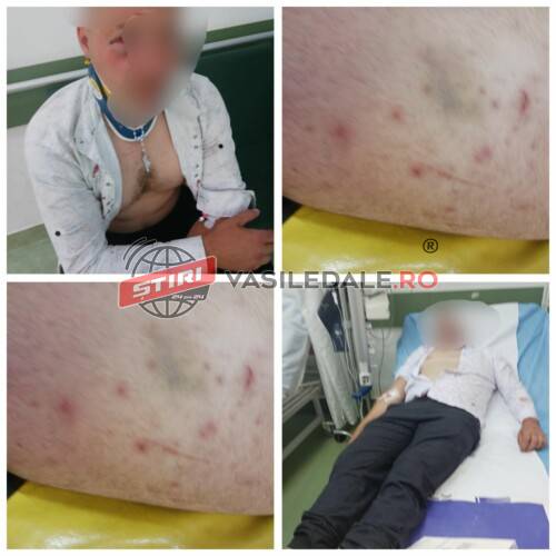 EXCLUSIV: Bărbat bătut crunt de un grup de tineri la o nuntă din Ferești! (foto / video – actualizare)