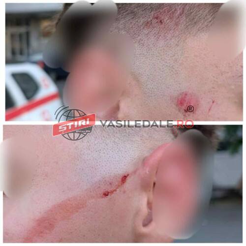 EXCLUSIVITATE: O IA LUMEA RAZNA, NU VĂ FACEȚI SINGURI DREPTATE – Adolescent lovit în cap cu bâta de un băimărean deranjat de gălăgie