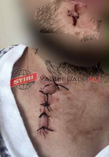 SCANDAL într-un bar din Leordina. Un tânăr din Ruscova a ajuns la spital. Suspectul are 18 ani (foto)